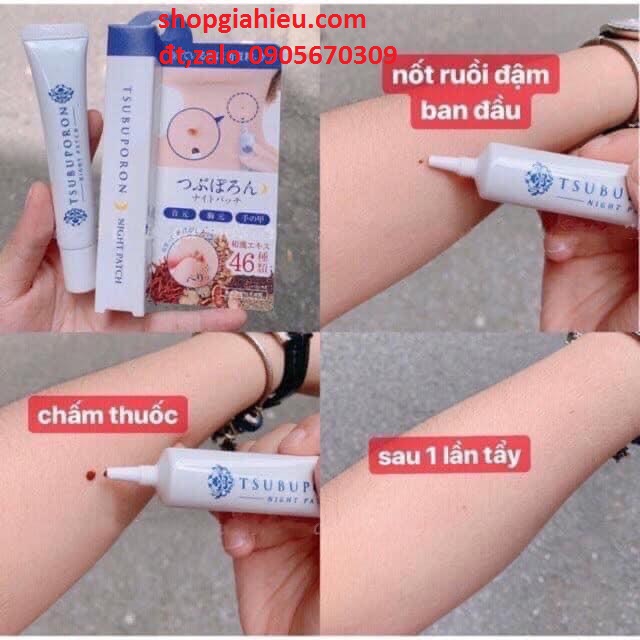 KEM TẨY NỐT RUỒI TSUBUPORON NIGHT PATCH Nhật Bản KEM TẨY NỐT RUỒI TSUBUPORON NIGHT PATCH Nhật Bản